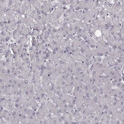 Invitrogen CCDC64 Polyclonal Antibody 100 &mu;L; Unconjugated:Antibodies,