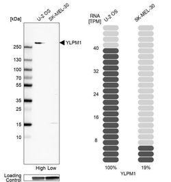 Invitrogen YLPM1 Polyclonal Antibody 100 &mu;L; Unconjugated:Anticuerpos