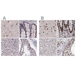 SR140 Polyclonal Antibody, Invitrogen 100 &mu;L; Unconjugated:Antibodies,