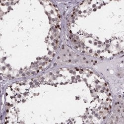 SR140 Polyclonal Antibody, Invitrogen 100 &mu;L; Unconjugated:Antibodies,
