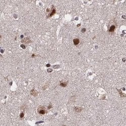 SR140 Polyclonal Antibody, Invitrogen 100 &mu;L; Unconjugated:Antibodies,
