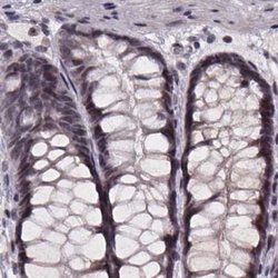 SR140 Polyclonal Antibody, Invitrogen 100 &mu;L; Unconjugated:Antibodies,