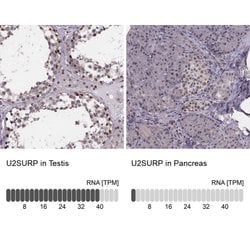 SR140 Polyclonal Antibody, Invitrogen 100 &mu;L; Unconjugated:Antibodies,