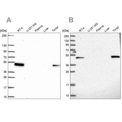 Invitrogen LPXN Polyclonal Antibody 100 &mu;L | Buy Online | Invitrogen&trade; | Fisher Scientific