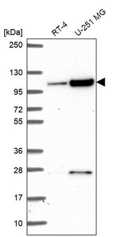 Invitrogen KIAA1614 Polyclonal Antibody 100 &mu;L; Unconjugated:Antibodies,