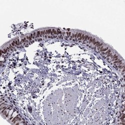 Invitrogen RPRD2 Polyclonal Antibody 100 &mu;L; Unconjugated:Antibodies,