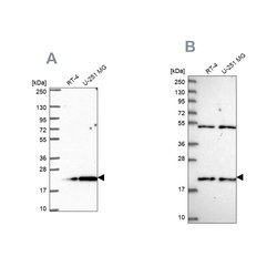 Invitrogen KIAA1143 Polyclonal Antibody 100 &mu;L; Unconjugated:Antibodies,