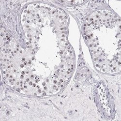 Invitrogen TEPP Polyclonal Antibody 100 &mu;L | Buy Online | Invitrogen&trade; | Fisher Scientific