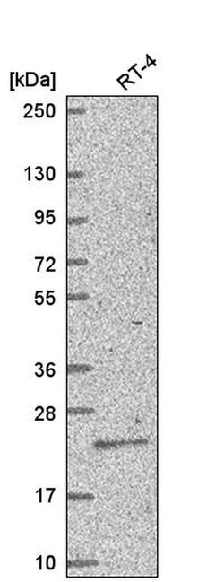 Invitrogen TGIF Polyclonal Antibody 100 &mu;L; Unconjugated:Antibodies,