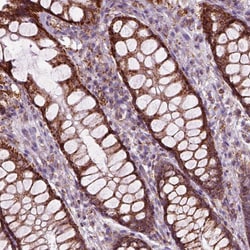 Invitrogen SLC25A24 Polyclonal Antibody 100 &mu;L; Unconjugated:Antibodies,