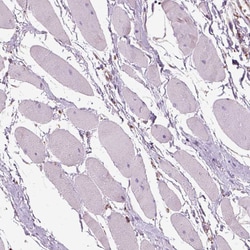 Invitrogen SLC25A24 Polyclonal Antibody 100 &mu;L; Unconjugated:Antibodies,