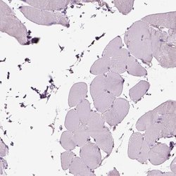 Invitrogen SLC25A24 Polyclonal Antibody 100 &mu;L; Unconjugated:Antibodies,