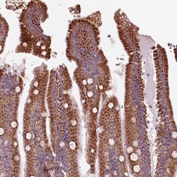 Invitrogen SLC25A24 Polyclonal Antibody 100 &mu;L; Unconjugated:Antibodies,