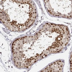 Invitrogen POLI Polyclonal Antibody 100 &mu;L | Buy Online | Invitrogen&trade; | Fisher Scientific