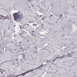 Invitrogen POLI Polyclonal Antibody 100 &mu;L | Buy Online | Invitrogen&trade; | Fisher Scientific