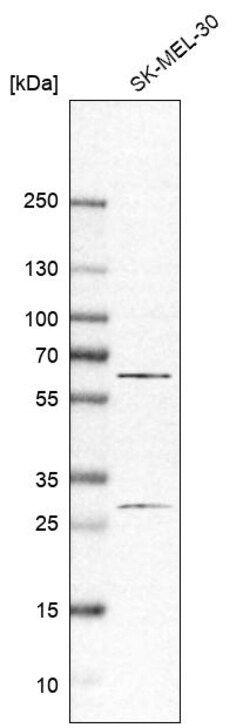 Invitrogen Asparagine Synthetase Polyclonal Antibody 100 &mu;L | Buy Online | Invitrogen&trade; | Fisher Scientific