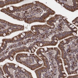 Invitrogen ZDHHC21 Polyclonal Antibody 100 &mu;L; Unconjugated:Antibodies,