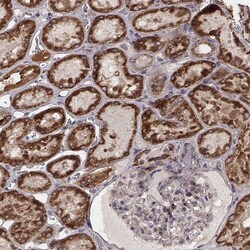Invitrogen ZDHHC21 Polyclonal Antibody 100 &mu;L; Unconjugated:Antibodies,
