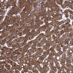 Invitrogen ZDHHC21 Polyclonal Antibody 100 &mu;L; Unconjugated:Antibodies,
