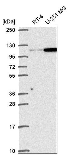 Invitrogen Gemin 4 Polyclonal Antibody 100 &mu;L | Buy Online | Invitrogen&trade; | Fisher Scientific