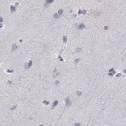 Invitrogen Histone H1T Polyclonal Antibody 100 &mu;L; Unconjugated:Antibodies,