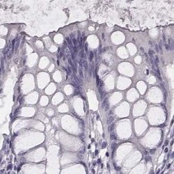 Invitrogen Histone H1T Polyclonal Antibody 100 &mu;L; Unconjugated:Antibodies,