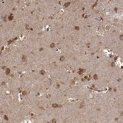 Invitrogen TARSL2 Polyclonal Antibody 100 &mu;L; Unconjugated:Antibodies,