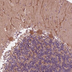 Invitrogen CMIP Polyclonal Antibody 100 &mu;L; Unconjugated:Antibodies,