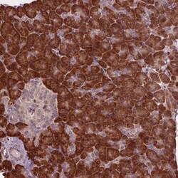 Invitrogen CMIP Polyclonal Antibody 100 &mu;L; Unconjugated:Antibodies,