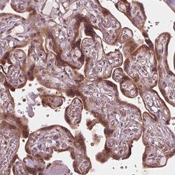 Invitrogen CMIP Polyclonal Antibody 100 &mu;L; Unconjugated:Antibodies,
