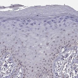 Invitrogen RBM24 Polyclonal Antibody 100 &mu;L; Unconjugated:Antibodies,
