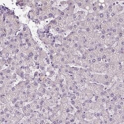 IFT52 Polyclonal Antibody, Invitrogen&trade; 100 &mu;L; Unconjugated 