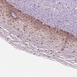 Invitrogen PSMD11 Polyclonal Antibody 100 &mu;L; Unconjugated:Antibodies,