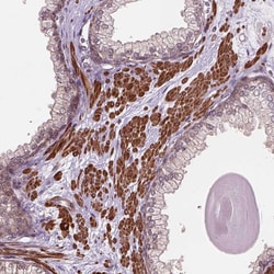 Invitrogen PSMD11 Polyclonal Antibody 100 &mu;L; Unconjugated:Antibodies,