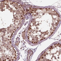 Invitrogen PSMD11 Polyclonal Antibody 100 &mu;L; Unconjugated:Antibodies,