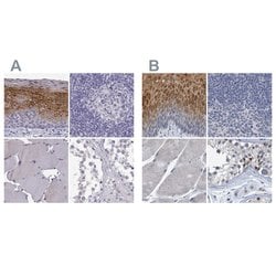 Invitrogen PP11 Polyclonal Antibody 100 &mu;L; Unconjugated:Antibodies,