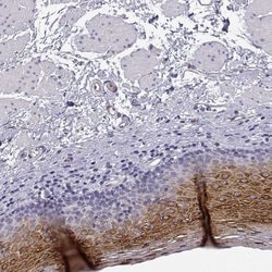 Invitrogen PP11 Polyclonal Antibody 100 &mu;L; Unconjugated:Antibodies,
