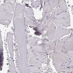 Invitrogen PP11 Polyclonal Antibody 100 &mu;L; Unconjugated:Antibodies,