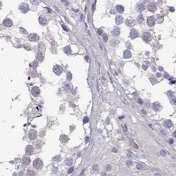 Invitrogen PP11 Polyclonal Antibody 100 &mu;L; Unconjugated:Antibodies,