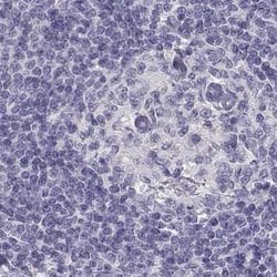 Invitrogen PP11 Polyclonal Antibody 100 &mu;L; Unconjugated:Antibodies,