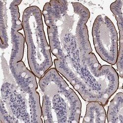 Invitrogen SLC22A18 Polyclonal Antibody 100 &mu;L; Unconjugated:Antibodies,