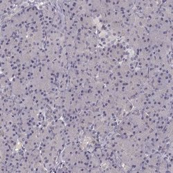 Invitrogen SLC22A18 Polyclonal Antibody 100 &mu;L; Unconjugated:Antibodies,