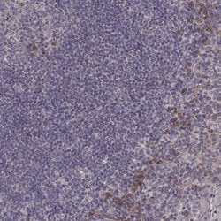 Invitrogen P2X5 Polyclonal Antibody 100 &mu;L; Unconjugated:Antibodies,