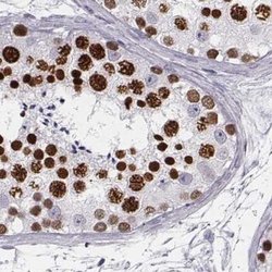 Invitrogen Histone H1T Polyclonal Antibody 100 &mu;L; Unconjugated:Antibodies,