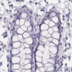 Invitrogen Histone H1T Polyclonal Antibody 100 &mu;L; Unconjugated:Antibodies,