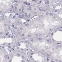 Invitrogen Histone H1T Polyclonal Antibody 100 &mu;L; Unconjugated:Antibodies,