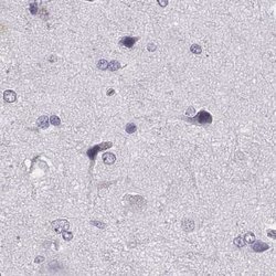 Invitrogen Histone H1T Polyclonal Antibody 100 &mu;L; Unconjugated:Antibodies,
