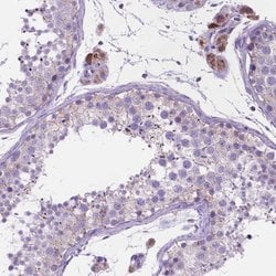 Invitrogen CECR6 Polyclonal Antibody 100 &mu;L; Unconjugated:Antibodies,