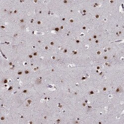 Invitrogen LUC7L Polyclonal Antibody 100 &mu;L; Unconjugated:Antibodies,