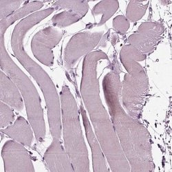 Invitrogen GDF11 Polyclonal Antibody 100 &mu;L; Unconjugated:Antibodies,